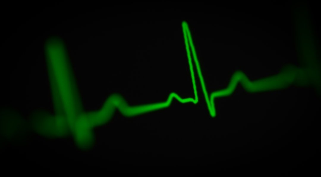 Demystifying Electrocardiograms: Understanding the Basics of ECGs